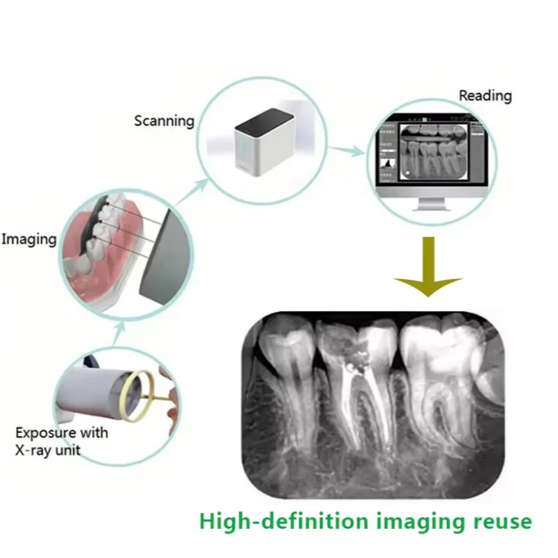 Dental Digital X-Ray Phosphor Plates X Ray Sensor Imaging Scanner Plate Metal-Free Imaging Sensors for Professional Dentistry