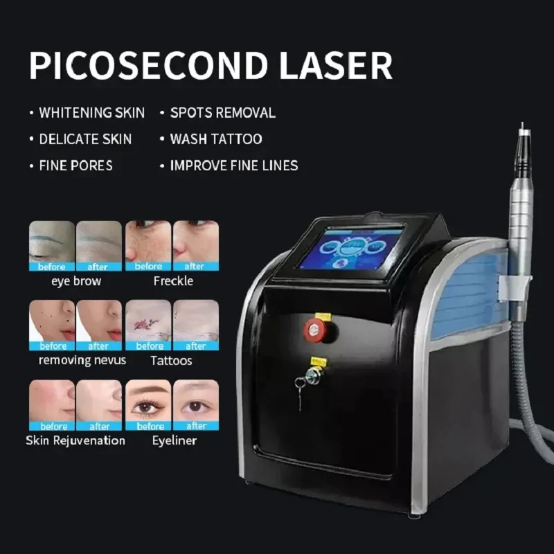 Picolaser Eyebrow Washing 1064/755nm Removing Frecklesand Washing Tattoos Its Dark Pigment Black-faced Doll Oil Controlwhitening