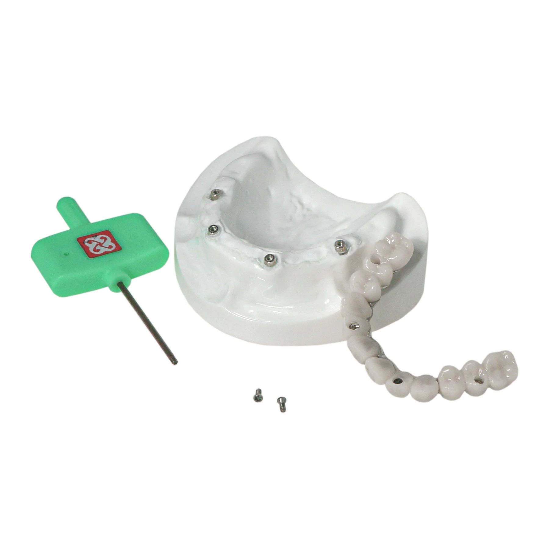 Implant Model Upper Jaw 4 Implants Removable Overdenture Model with Screwdriver Dental Teaching Model for DentistStudent