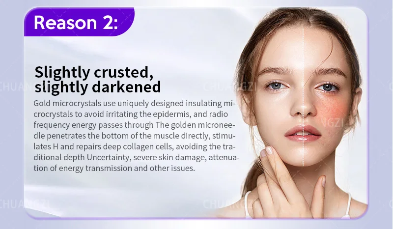 2 In 1 Fractional RF Microneedling Machine Portable Radio Frequency Skin Tightening Device With Cold Hammer For Face Neck Stretc