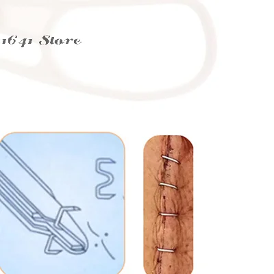 

1 шт. Белый одноразовый кожный степлер, инструмент для удаления хирургических кожных скоб, из нержавеющей стали и пластика, с вытягивателем скоб