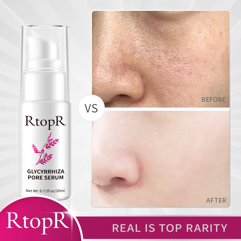 RtopR Glycyrrhiza Face Pore Repair Serum Collagen Face Anti Wrinkle Whitening Cream Oil Control Hydrating Effective Shrink Pores