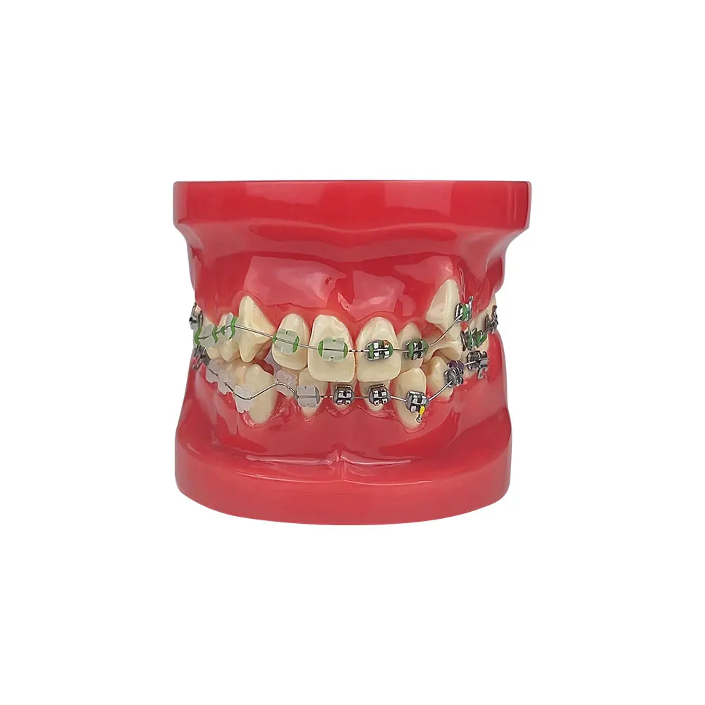 Orthodontic Teaching Model Half Metal Half Ceramic Bracket for Dentist Student Practice Studying Doctor-patient Communication