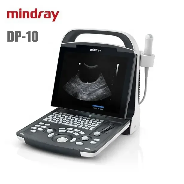 Mindray Dp10 Vet Black White Ultrasound Veterinary Use Ultradound With Battery Dp10 Veterianary Scanner