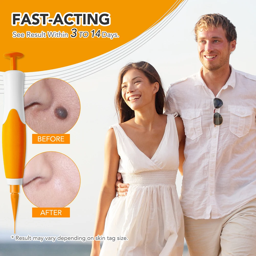 

Rubber Rings Skin Tag Removal Device Face Beauty Accessories Remove Skin Wart Kits Multipurpose Supplies for Face Neck Chin Back