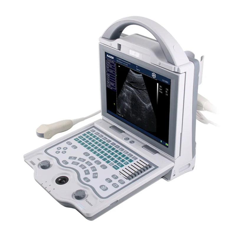 Human And Animal Portable Ultrasound Scanner Machine Black And White Vet Ultrasound Scan Cheap Price KX5600