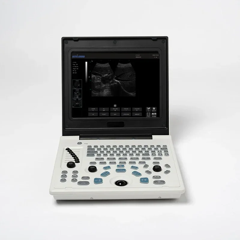 12 Inch LED Laptop Portable Notebook USG Ultrasound Scanner Machine