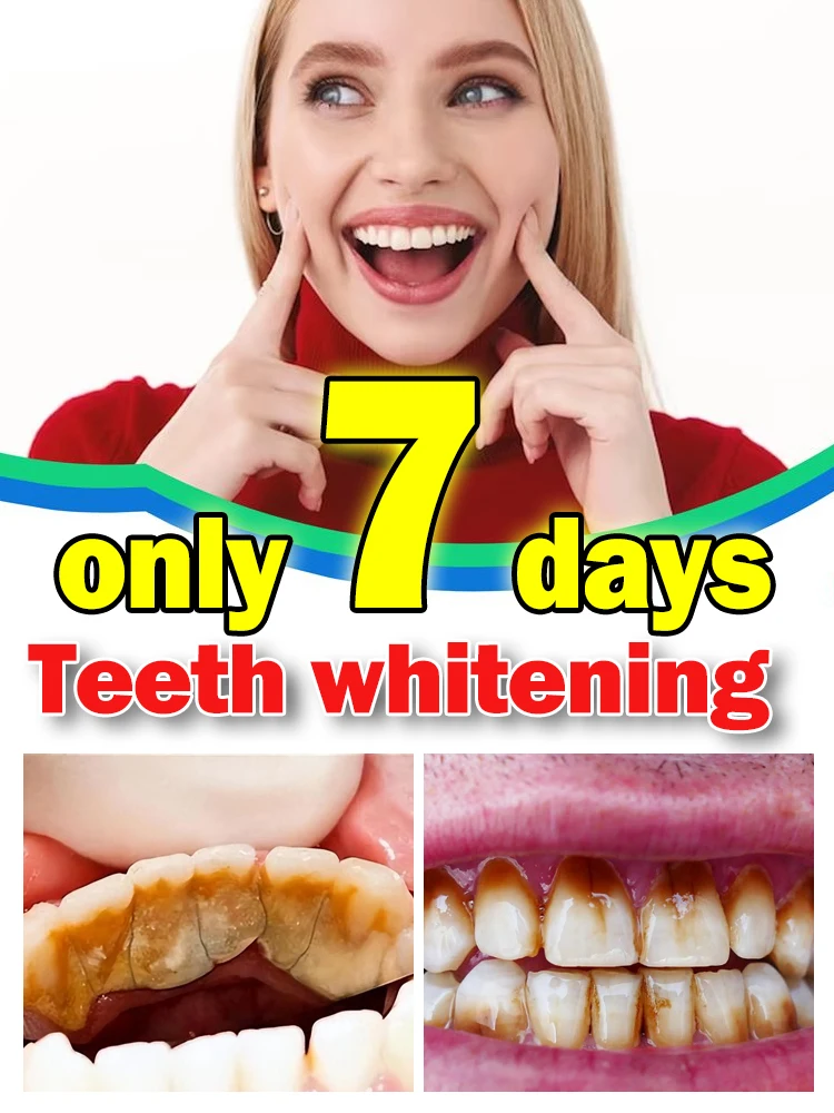 

Dental care, removal of stains, stones, fresh breath