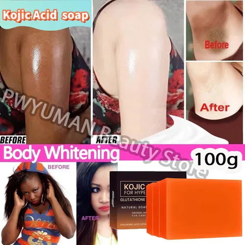 Jabón hecho a mano con ácido kójico de cúrcuma, 100g /200g/300g, aclara la piel oscura, blanquear el cuerpo, exfoliación de las axilas, limpieza profunda, ilumina el cuidado de la piel