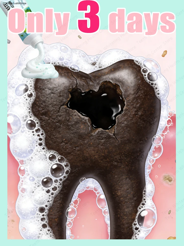 

Не допускайте, чтобы кариес стал большим проблемой, его можно восстановить за 3 дня.