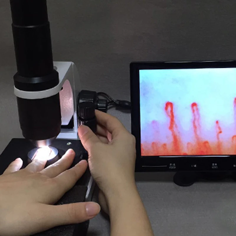 

Biological Blood Capillary Microcirculation Blood Microcirculation test Machine