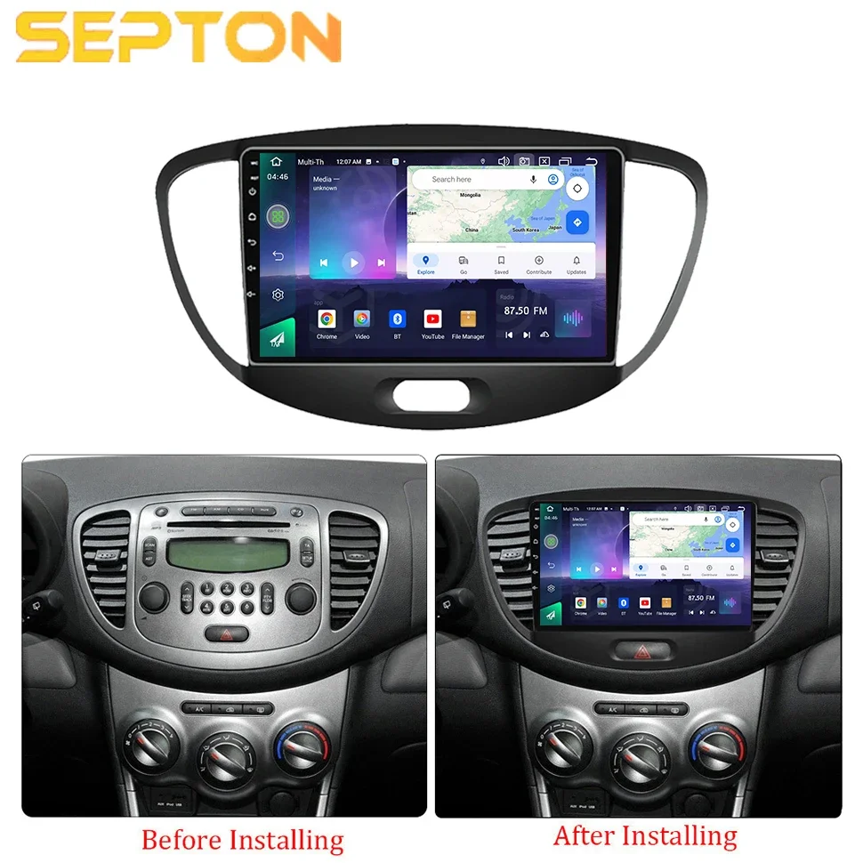 SEPTON Smart Car Systems Car Radio for Hyundai I10 2007-2013 4G CarPlay Multimedia Player WiFi GPS Head Unit Car Audio Stereo