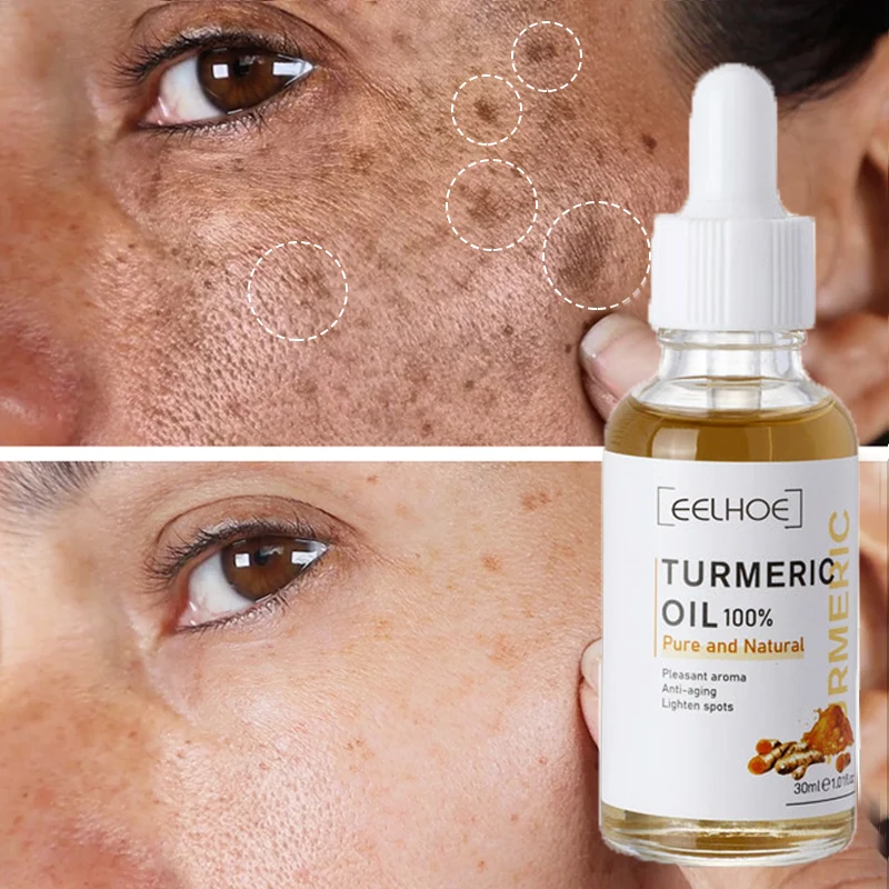 

Anti-aging Get Rid of Dark Spots Turmeric Oil Serum Lighten Facial Fine Lines Acne Moisturizing Brightening Skin Essence 30ml