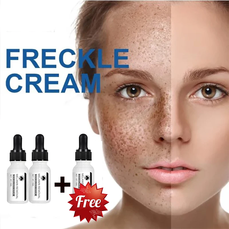 

Whitening Freckles Face Serum Remove Melasma Dark Spots Removal Cream Fade Melanin Acne Anti-Aging Brighten Skin Care