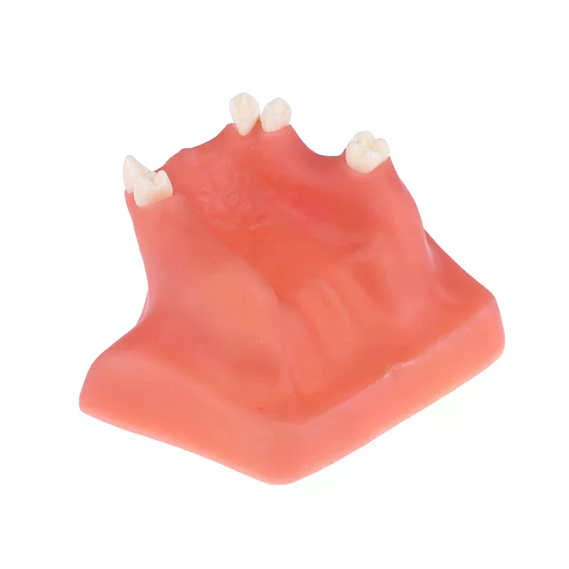 

Dental Model Teeth Implant Maxillary Mandibular Sinus Practice Teeth Model Implants Dentist Practice Studying Tools