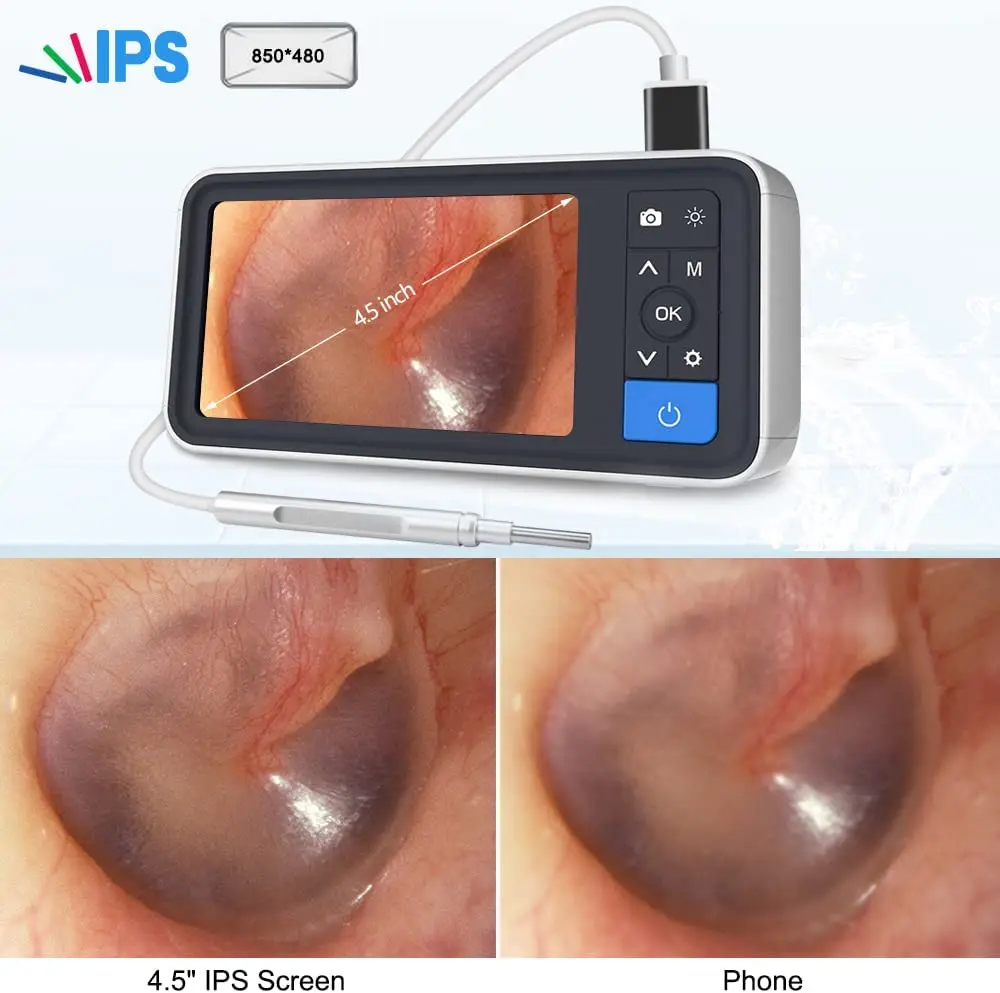 3.9mm 1080P HD Digital Otoscope with 4.5 Inches Screen Ear Scope Endoscope Ear Cleaner With 2500mAh Battery