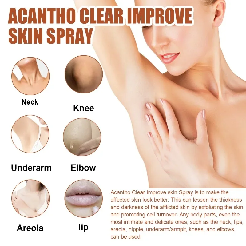 Acantho clear spray Armpit Elbow Knee joint Dark Knuckle Removal Whitening Serum Thigh Inner improve Melanin Dull body skin care