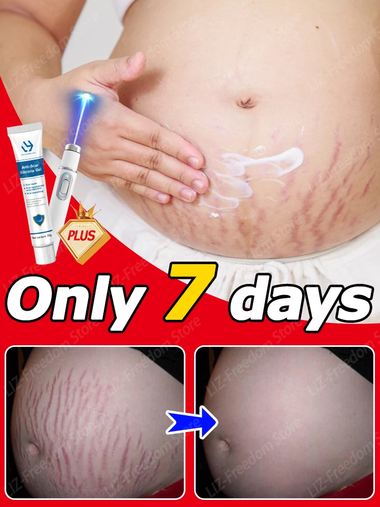 

Pregnancy Stretch Marks Eliminate Red White Old Surgical Cream Repair Firming