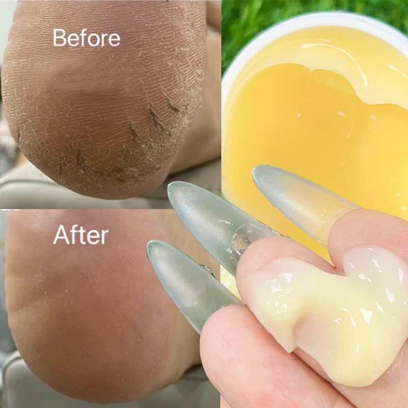 Hand Foot Care Cream Anti-Drying Crack Heel Cracked Repair Removal Dead Skin Callus Softening Moisturizing Hands Foot Skin Care