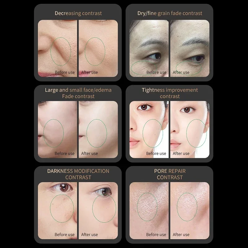 EMS 미세전류 피부 탄력 페이스 리프팅 마사지기 레드 라이트 콜라겐 재생 안티에이징 RF 주름 방지 뷰티 디바이스