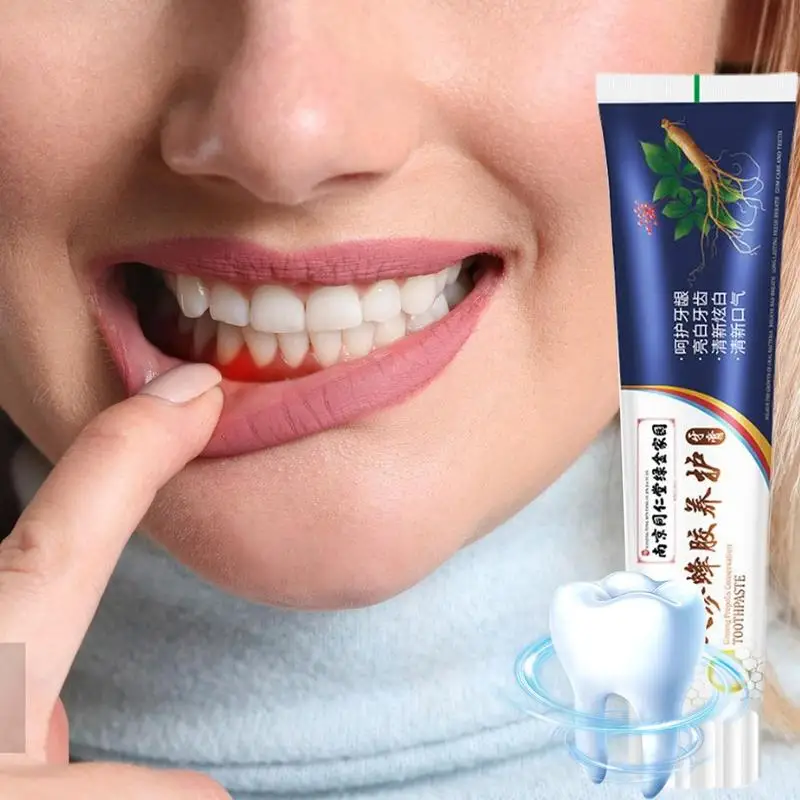 Gums mancha remoção Tooth Paste, remoção de mau hálito, Ginseng Própolis dentífrico, profundamente limpeza, cuidados dentes soltos, 100g