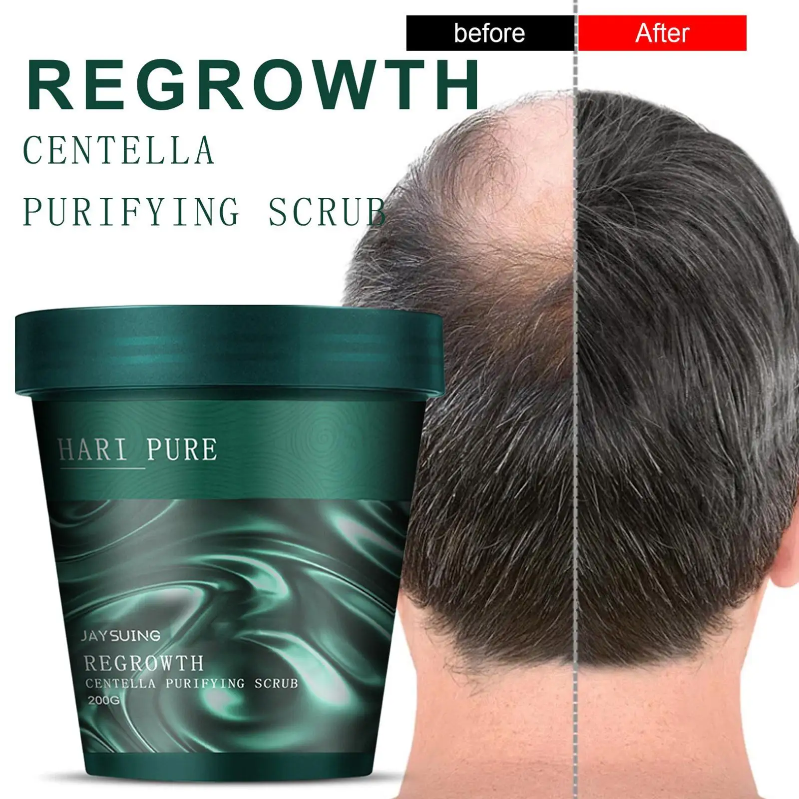 200g Centella Asiatica Exfoliating Scalp Care Scrub Repair Centella Deep Oil Follicle Asiatica Hair Cleansing C1K4