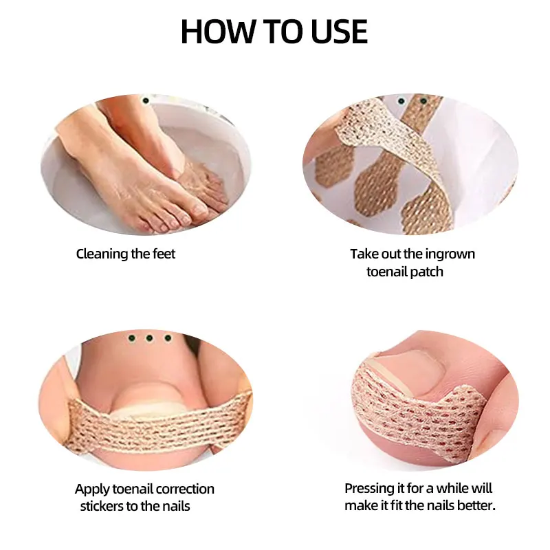 50-300 pezzi Toppe per protezione unghie, Toppe per unghie dei piedi, Adesivi per unghie per unghie Adesivi per unghie dei piedi per unghie dei piedi e delle unghie