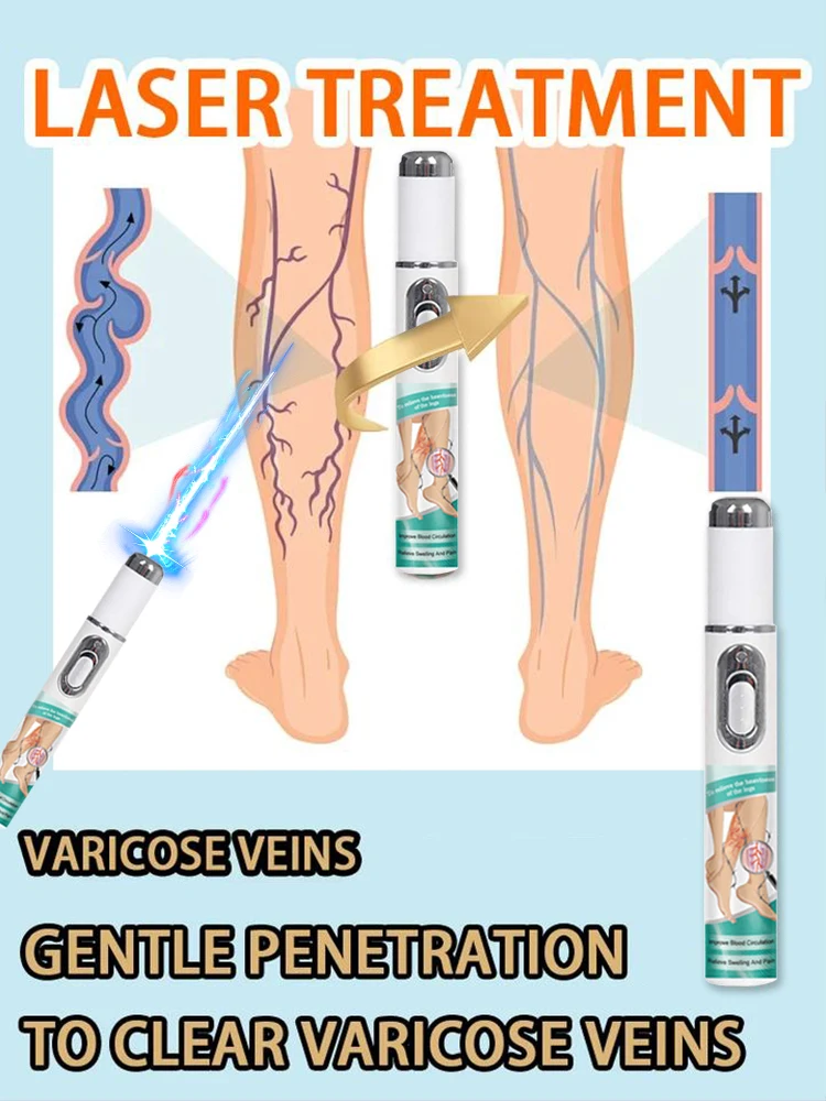 

blue light pen solve varicose veins, hot sale leg care tools