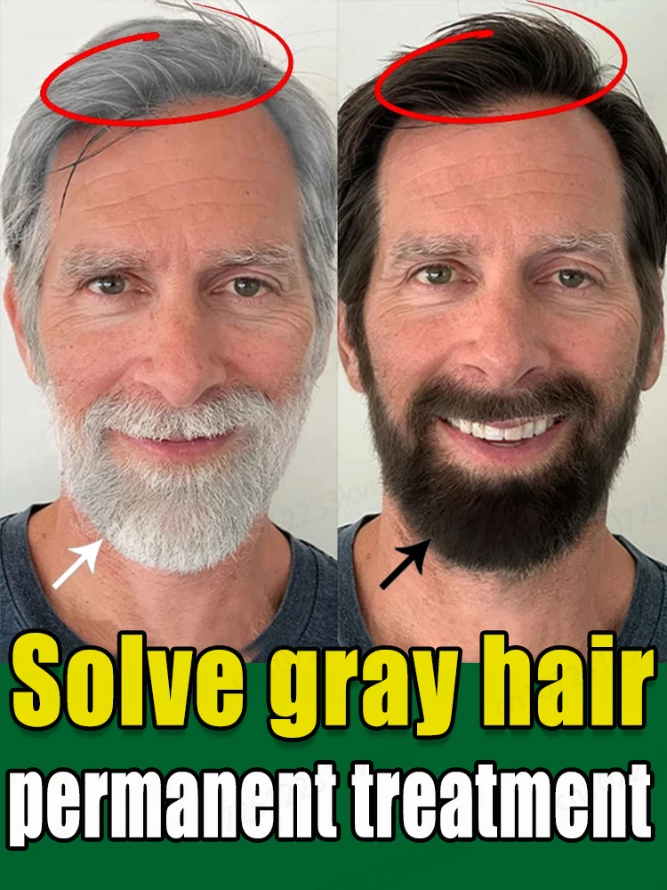 Hot-selling product, 99% of buyers repurchase, repair gray hair, say goodbye to gray hair, make hair healthy again