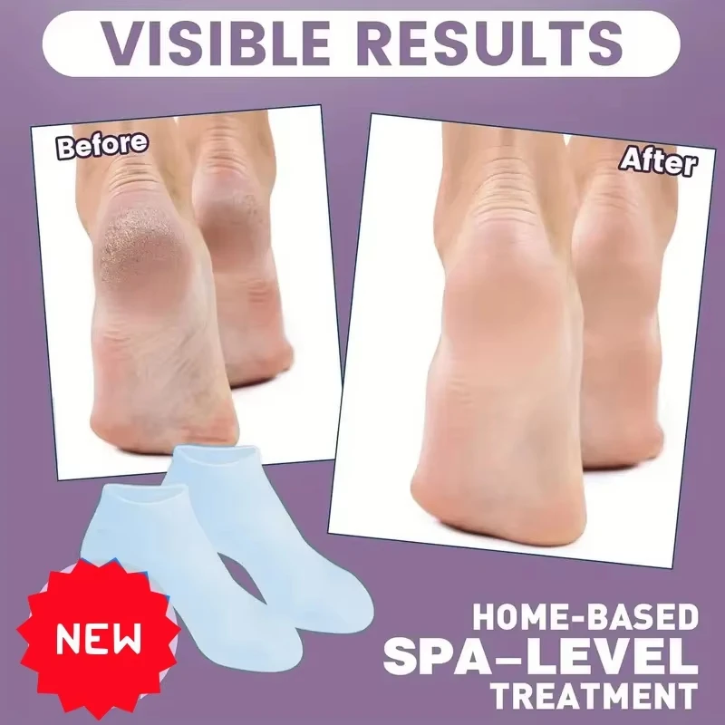 1 Pair Silicone Gel Moisturizing Foot Socks for Dry, Cracked Feet - Soothing Massage Pedicure Care Tool