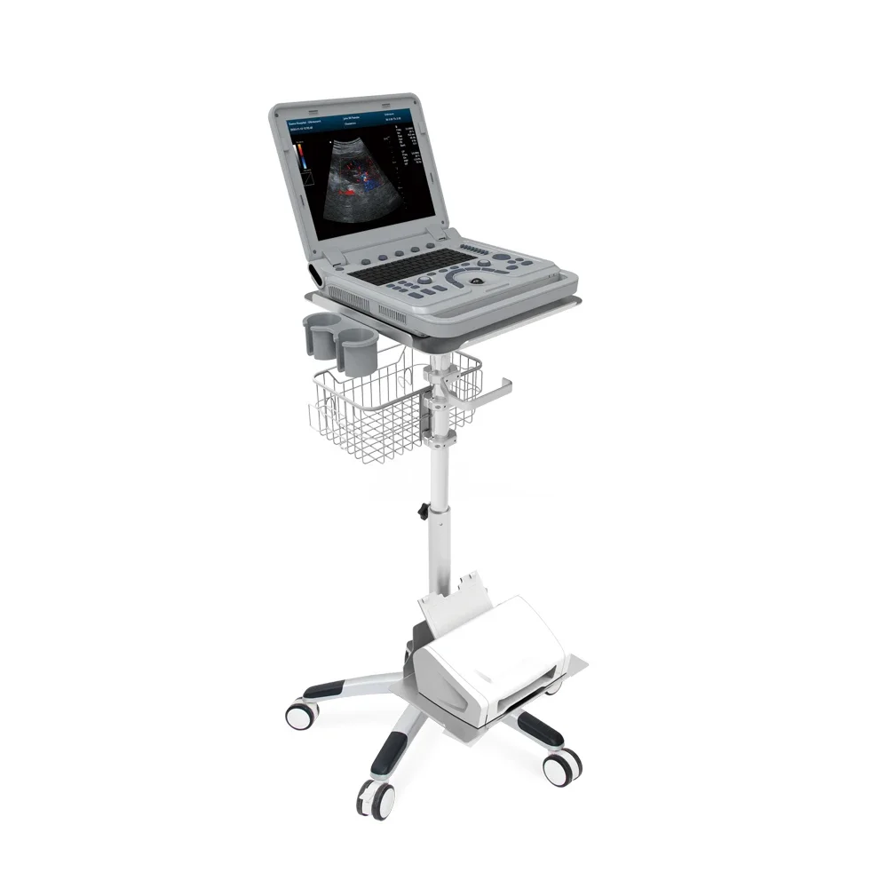 CONTEC CMS1700A  medical Color Doppler cardiac ultrasound equipment