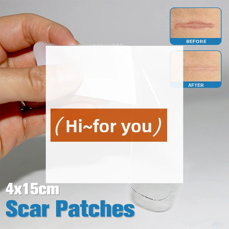 4x15cm Scar Patches Remove Silicone Gel Sheet  Patch Ear Correctors Burn Wounds Efficient Surgery Scar Tape Skin Repair