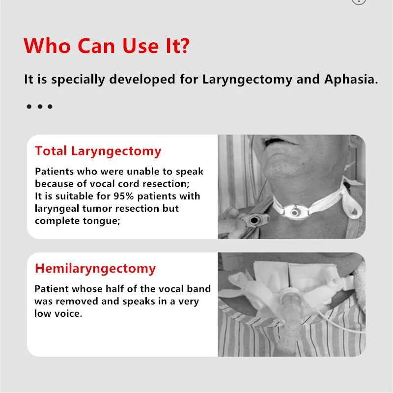 Artificial Electronic Larynx Speech Speaker Laryngectomees Laryngophonic Apparatus Total Laryngectomy Electronic Larynx 2024