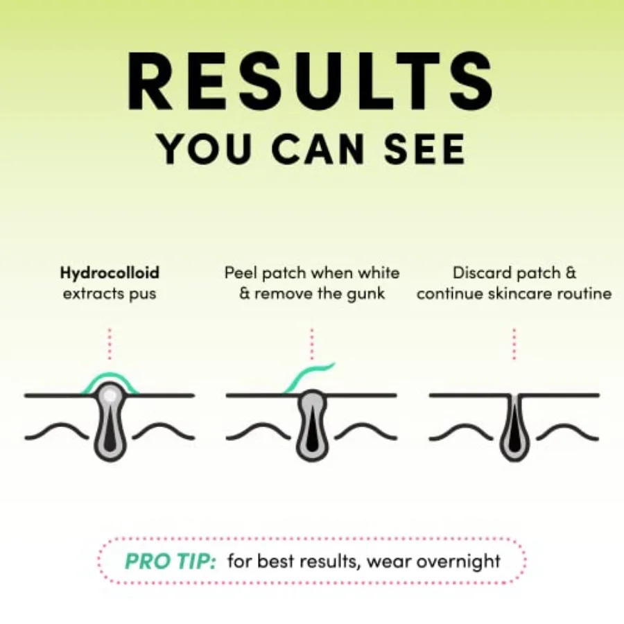 Pimple Patches For Face Fast Acting Translucent Hydrocolloid Zit Patches that Unclog Pores Korean Skincare Vegan Cruelty Free 6