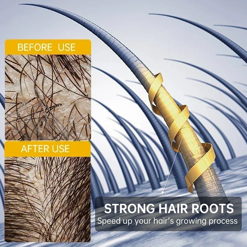 Biotin Fast Hair Growth Oil Hair Regrowth Serum aHair Thinning Treatment aHair Growth Liquid Anti-Hair Loss Baldness Serum