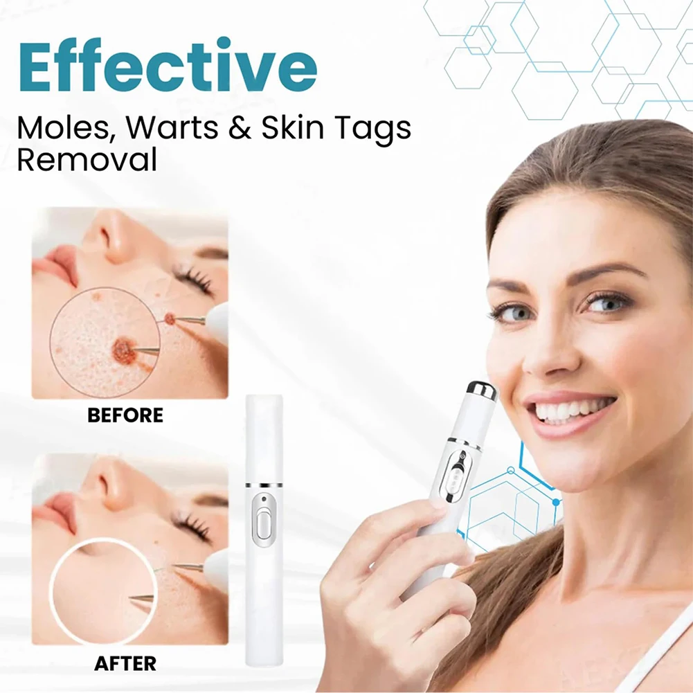 Mole and Wart Removal Pen Skin Tag Removal Pen Non Invasive Dark Spot Remover with Heat Wart Remover for All Skin Types