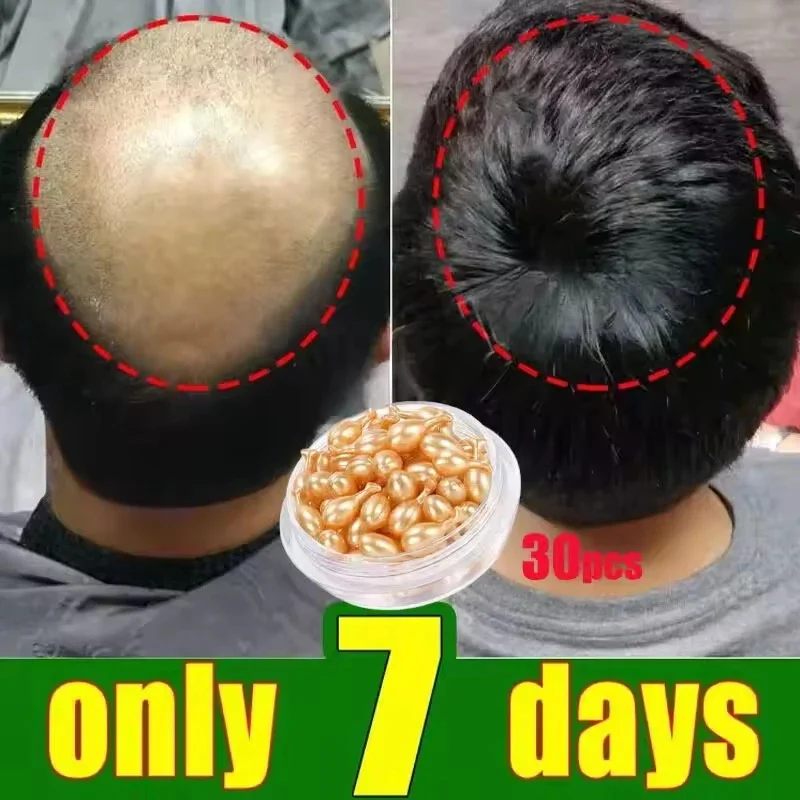 

Powerful 7-Day Rapid Regeneration Essence Capsule Anti Alopecia Baldness Repair Scalp Damage Nourish Hair Root Hair Care