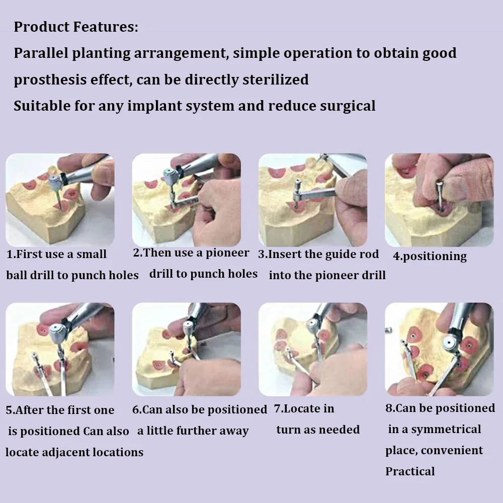 

Parallel Drill Guide Set for Dental Implants High Precision Implantation Position Locator Tool for Oral Surgery