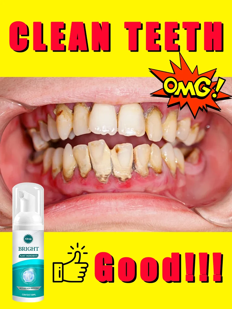 2025 Hotsale, strumenti per la cura della pulizia dei denti, bellezza, schiuma orale, spedizione gratuita