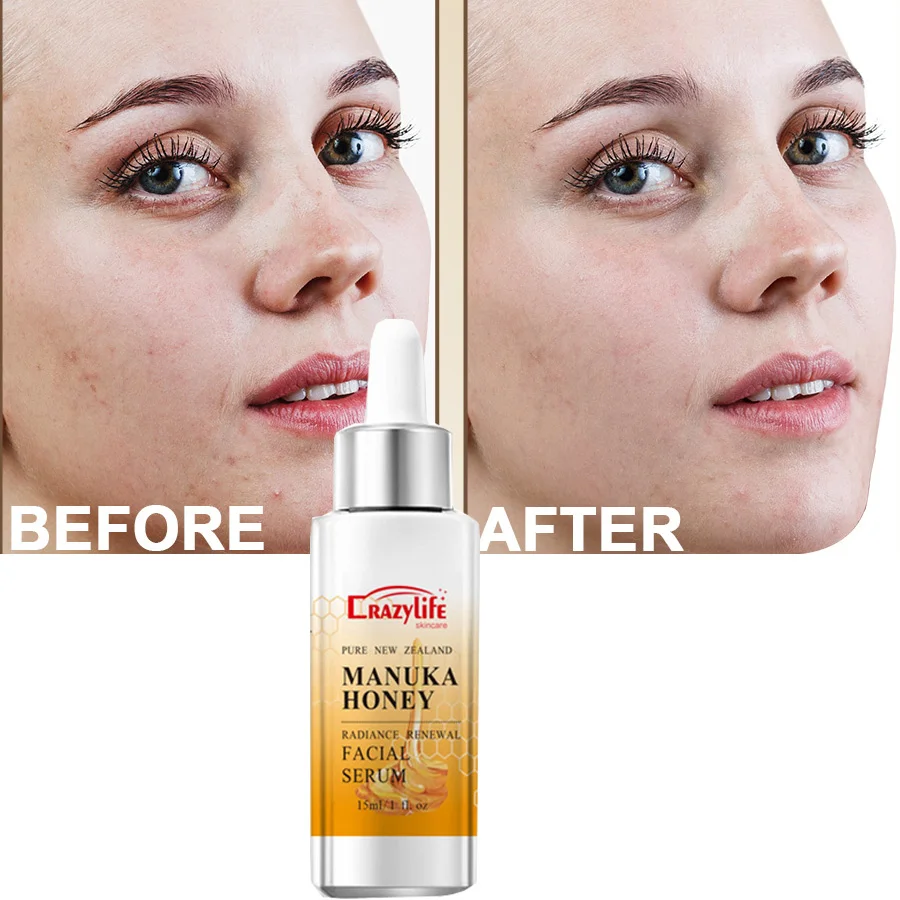 Manuka Honey Gold Face Serum Repairing Essence Moisturizing Oil Control Shrink Pores Lifing Anti-wrinkle Face Serum