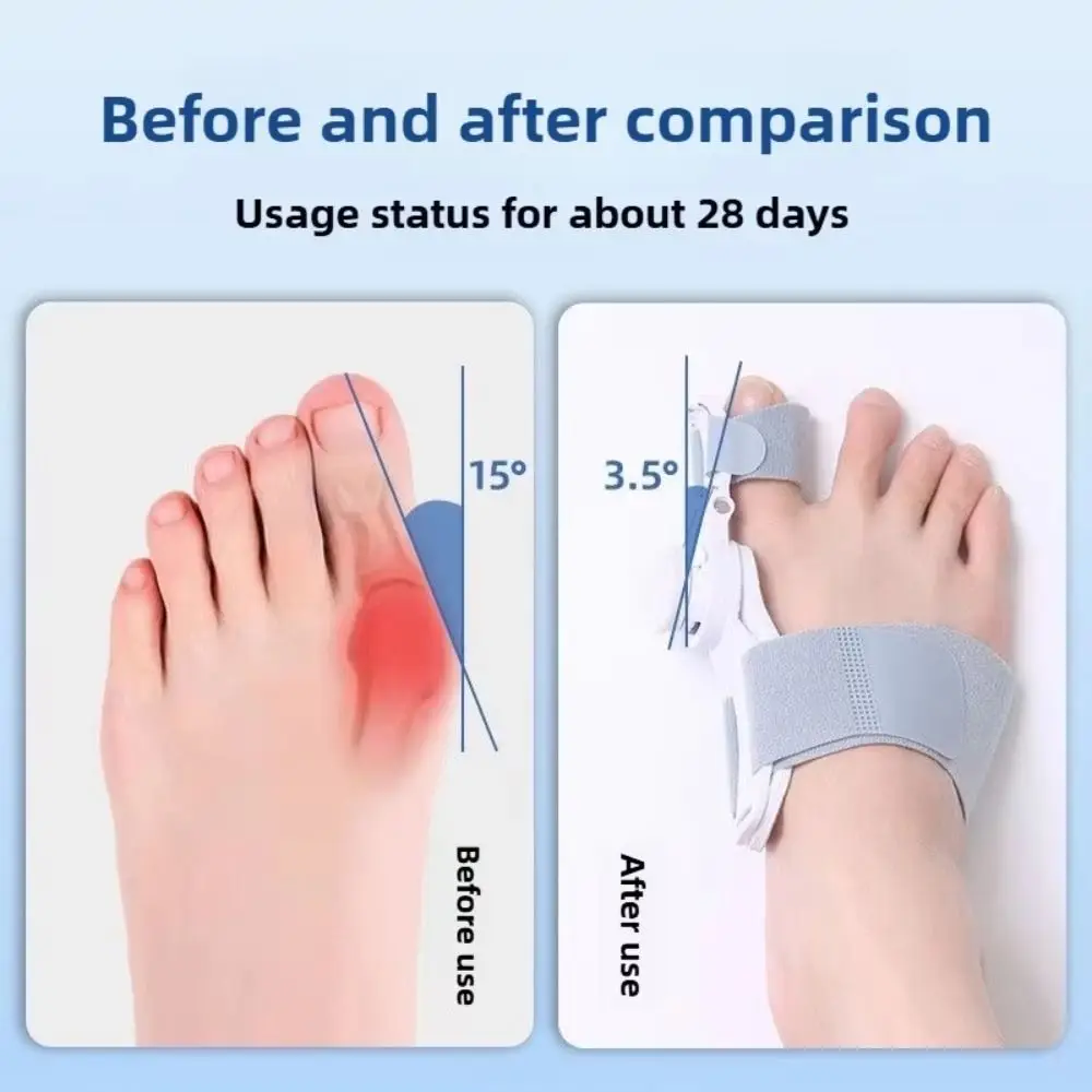 Rotatable Bunion Corrector Orthopedic Anti-slip Heel Hallux Valgus Corrector Adjustable Strap Toe Straightener Unisex