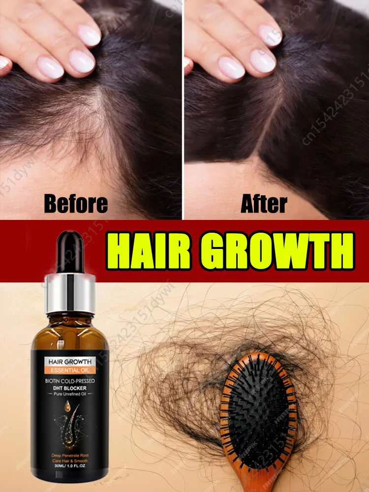 98% Of Buyers Buy Again,Have More And More Hair,Hot Selling Product