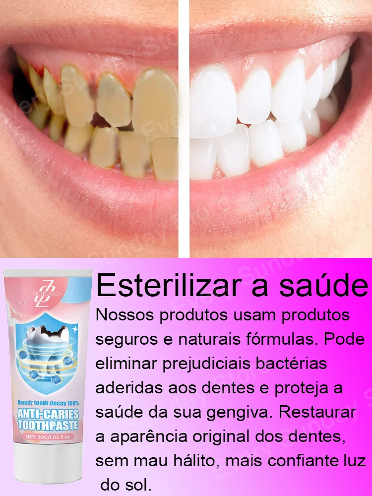 Producto vendedor caliente, el 99% de los compradores compran de nuevo, los dientes son mejor