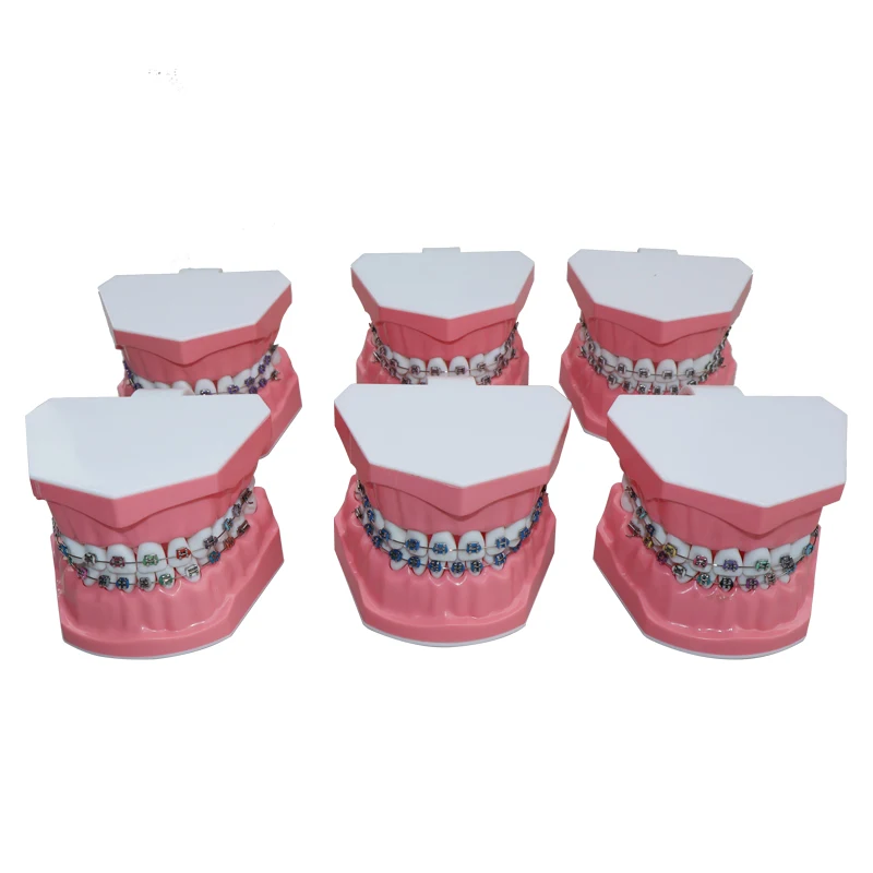 32 Teeth Dental Preparation Model With Orthodontic Braces, Simulated Jaw Typodont For Dental Teaching & Training