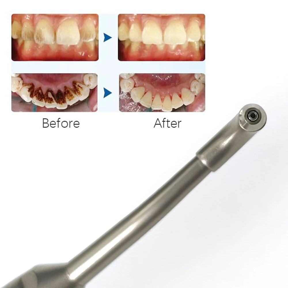 Higienist dentystyczny Prophy Mate NEO System polerowania zębów przepływ powietrza Polerka KV Multiflex Coupler Connect narzędzie stomatologiczne