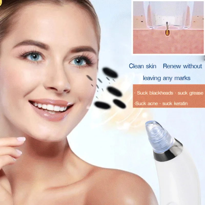 Removedor de cravo elétrico e poro limpador para mulheres, beleza facial e esfoliação, moda