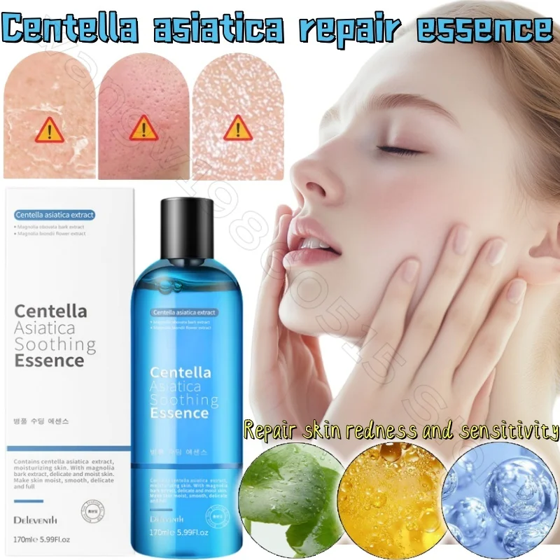 

Centella Assay Essence Water 170ml Deep Hydrating Moisturizing and Repairing Damaged and Red Sensitive Skin Essence Water