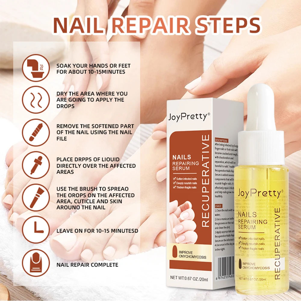 JoyPretty-Nail Fungal Tratamento Soro, Anti Infecção, Reparação Essência, Renovação do prego Nutritivo Gel, Unha Cuidados Produtos, Beleza