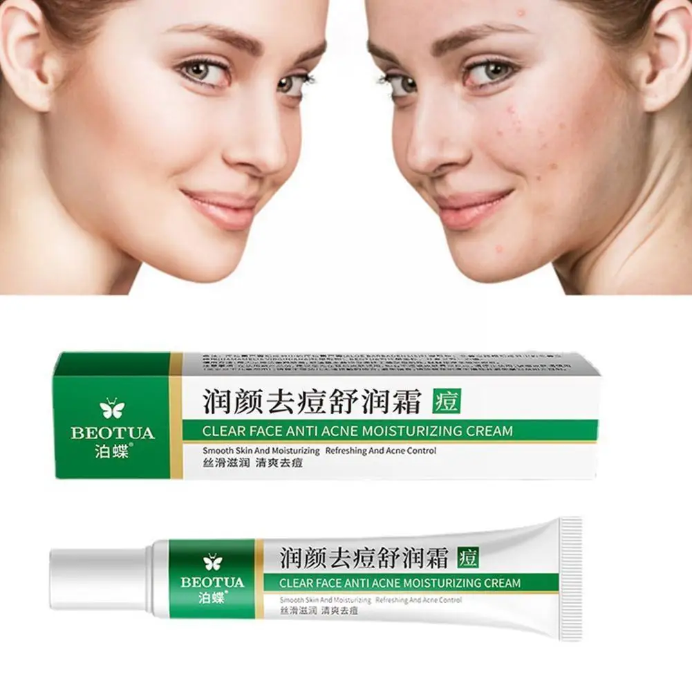 Effective Acne Removal Cream Herbal Acne Spots Oil Acne Whitening Care Skin Moisturizing Cream 20g Control Skin Face Gel Ca X4a1