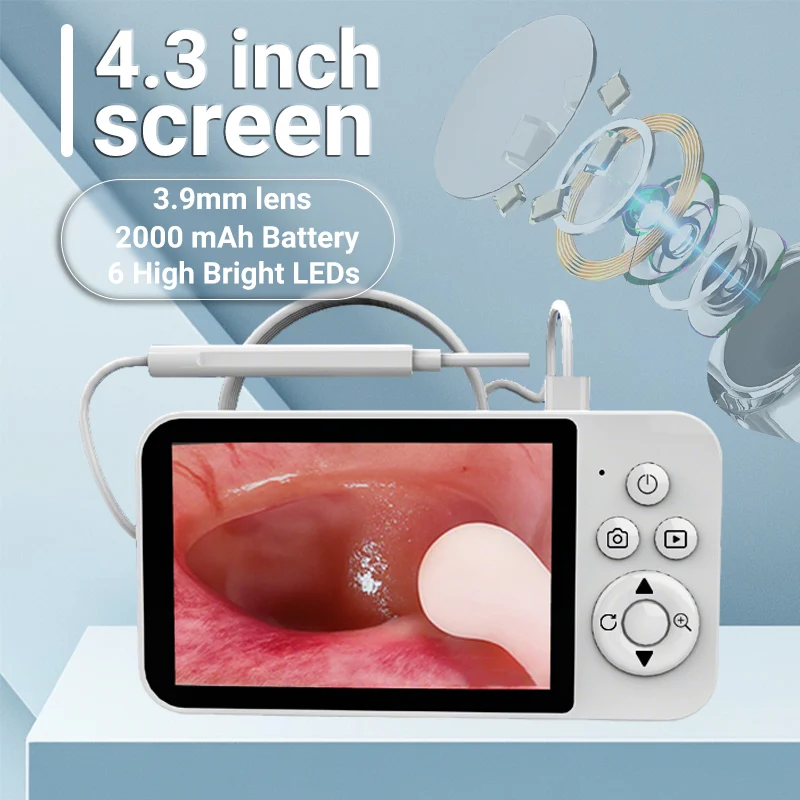 Otoscopio Digital Ultrafino con Pantalla HD de 4.3'', Kit de Herramientas para Remover Cera de Oídos con Cámara, Endoscopio para Adultos, Niños y Mascotas, Venta al Por Mayor